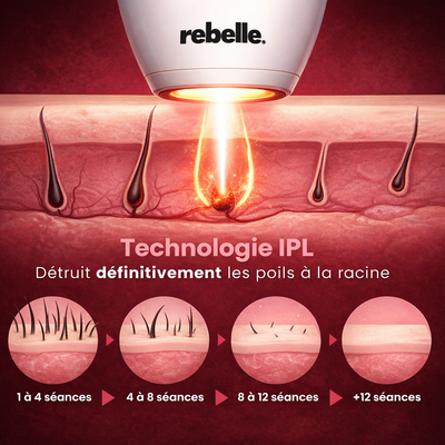 IPL Pulse — Épilation Définitive à Domicile