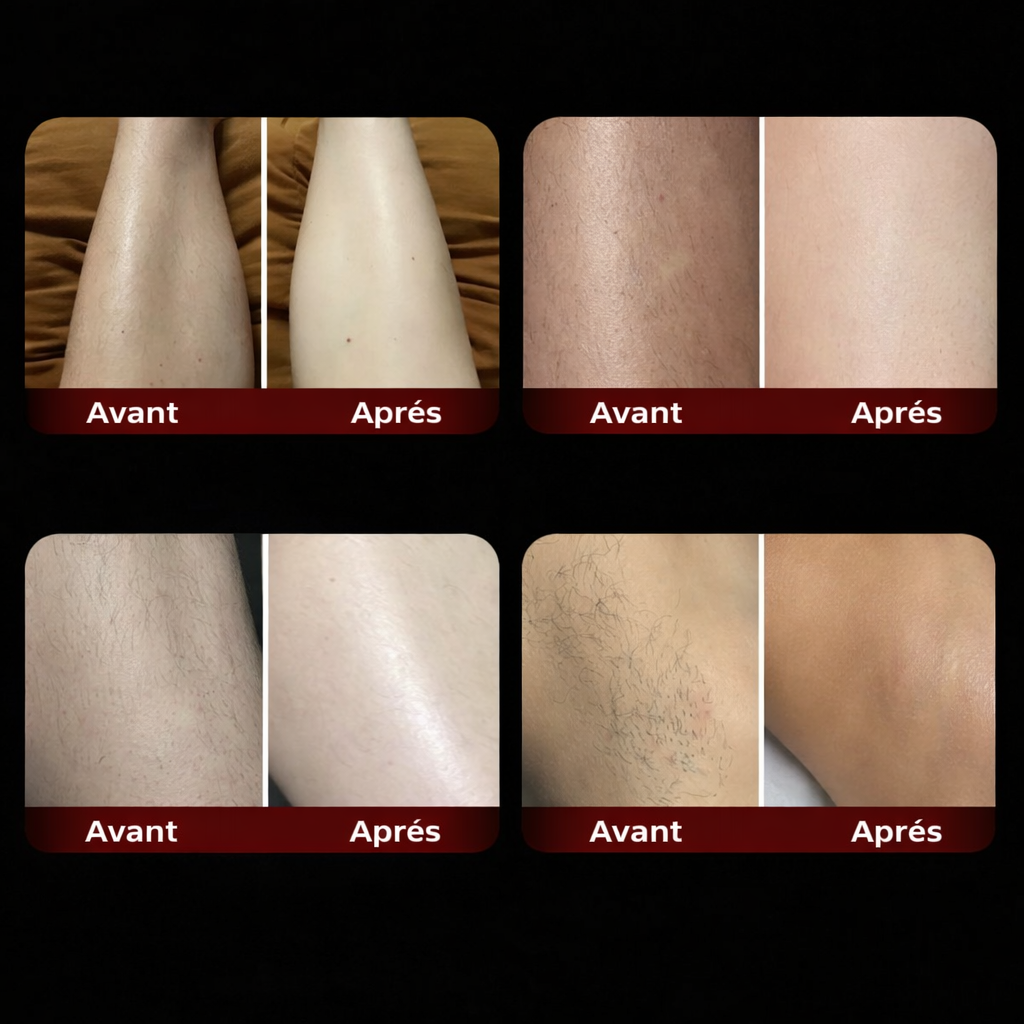 Silk Shaver — Épilateur Électrique 2-en-1