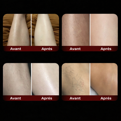 Silk Shaver — Épilateur Électrique 2-en-1